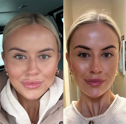 Wellness™ Micro-Toner