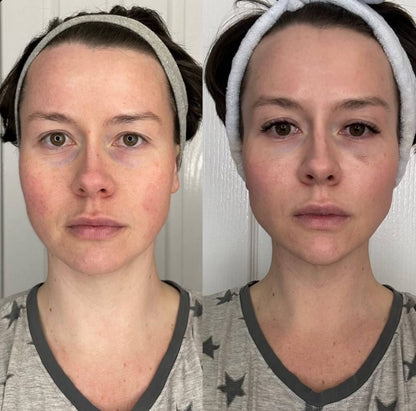 Wellness™ Micro-Toner